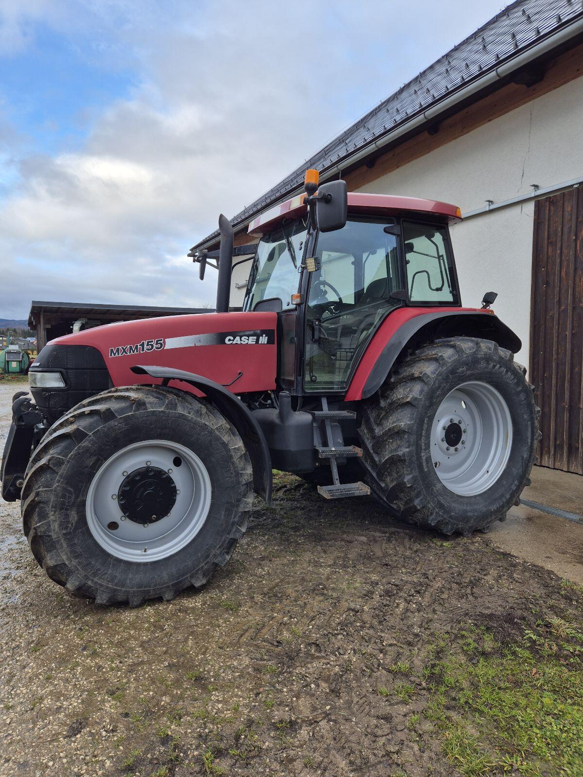 Case MXM 155 1