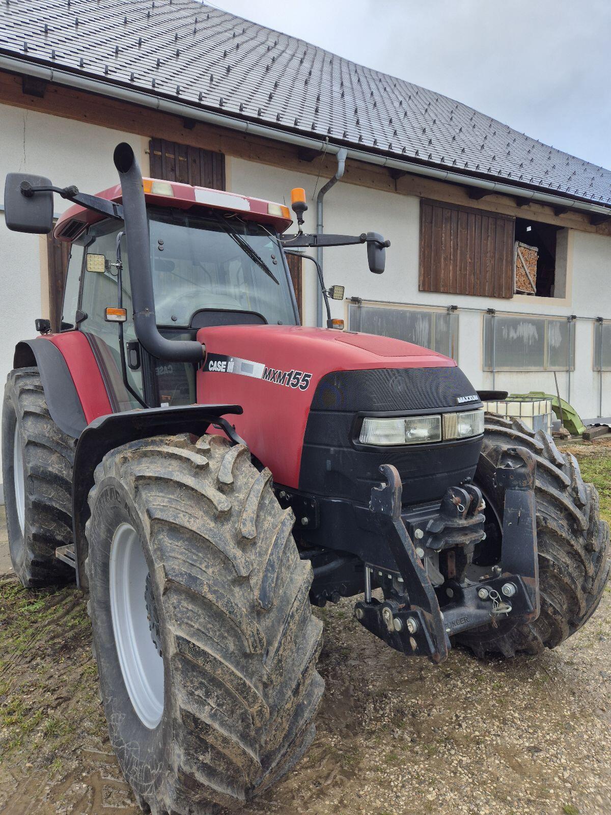 Case MXM 155 2